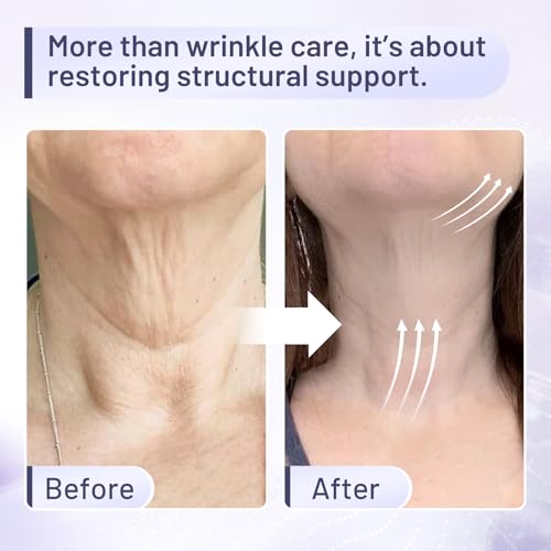 Premium Neck Firming Cream ? Lifting & Tightening for Neck & D?collet?, Reduces Fine Lines & Sagging, Anti-Aging Chest Treatment,1.8 Fl Oz