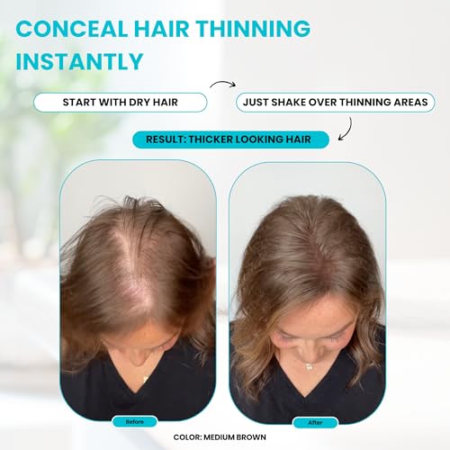 SURETHIK Keratin Hair Thickening Fibers Dark Brown 15g