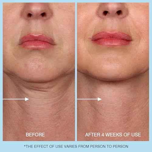 Retinol Neck Cream, Hyaluronic Acid and Caffeine Enriched Neck Firming Cream to Minimize Fine Lines & Dullness - 3-in-1 Moisturizing Cream for Neck, Chest and Face (50 ml/1.7 oz)