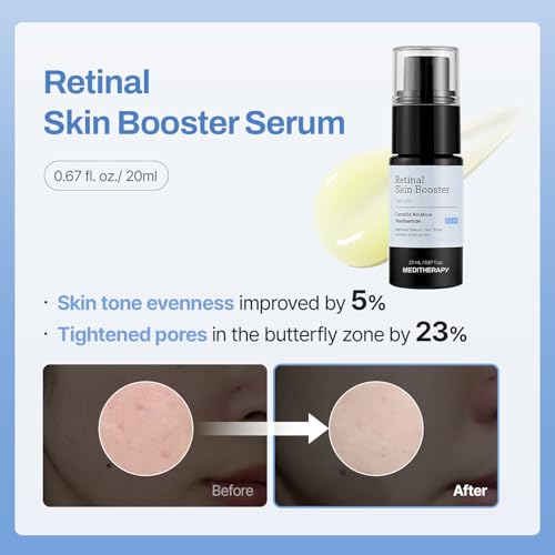 Meditherapy Gentle Boost Kit ? Korean Skin Care Set with Retinal & Hyaluronic Acid Serum & Squalane Moisturizer, Anti-Aging & Hydrating Routine, Beginner-Friendly, Travel & Gift