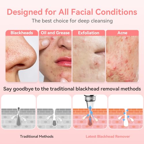 Blackhead Remover Pore Vacuum | USB Rechargeable with 5 Suction Levels