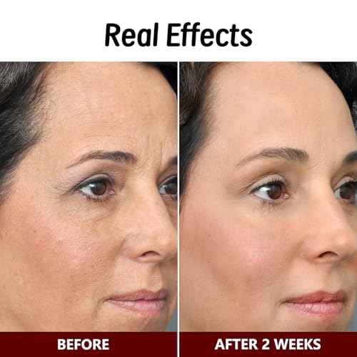 Bee Venom Skin Treatment Cream, Bee Venom Comprehensive Cream, Face lifting and firming, Effective In Reducing Skin Blemishes, Gentle and Non-irritating, Suitable For All Parts 2.1 Ounce (Pack of 1)