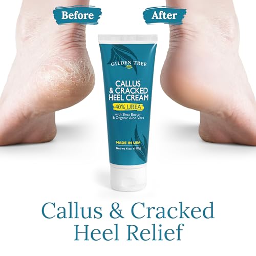 40% Urea Cream for Feet - Cracked Heel Treatment with Shea Butter & Aloe