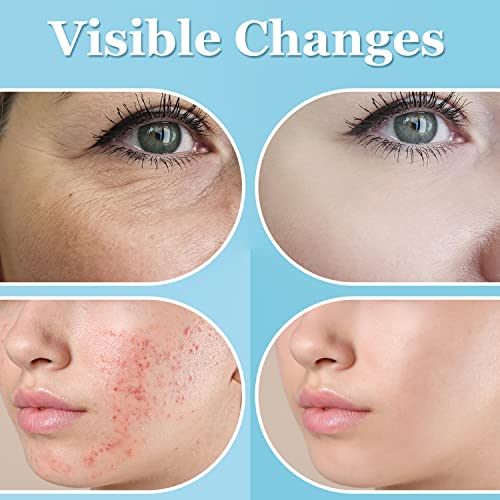 UUPAS High Frequency Facial Wand with 6 Orange Tubes