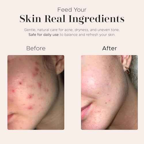 era of nature Best Raw ORGANIC AFRICAN BLACK SOAP, for Dry Skin and Skin Conditions. Pure & Natural Ingredients, Imported From Ghana - 3LB (48oz)