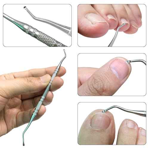 43 Pcs Callus Shaver for Feet Set, Foot Callus Shaver, (1 Stainless Foot File &1 Foot File Heads & 40 Replacement Slices Blades & 1 Nail Cleaning)