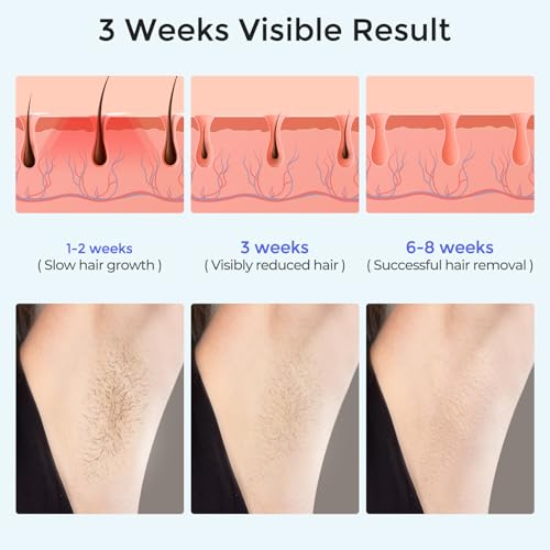 IPL Hair Removal Device with Sapphire Ice-Cooling for Women and Men, Painless and Permanent, Alternative to Salon, Bikini Shaver, Hair Removal for Armpits Legs Bikini Face