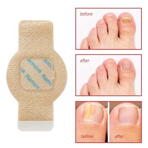 Nail Care Patches Self-Adhesive, 21 Count