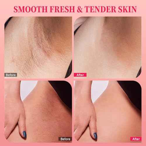 Bikini Area Exfoliator with 10% AHAs BHA & Vitamin C, Exfoliating Body Scrub for Ingrown Hair and Underarm Bumps, Dark Spots, Moisturize Brighten Soothe & Even Skin Tone, Sensitive Skin Safe, 7.76 oz