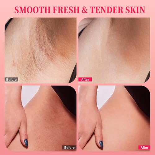 Bikini Area Exfoliator with AHA BHA & Vitamin C - 7.76 oz