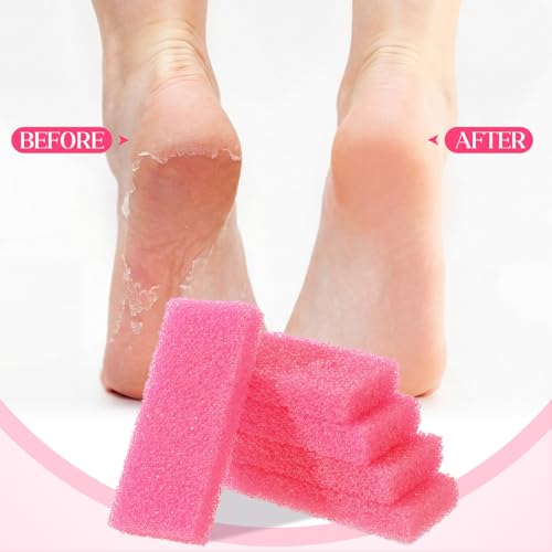 Batiyeer Disposable Pumice Stones for Feet - 100 Pack Foot Callus Remover (Pink)