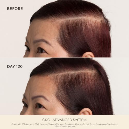 VEGAMOUR GRO+ Advanced Dermaroller for Scalp Hair Growth