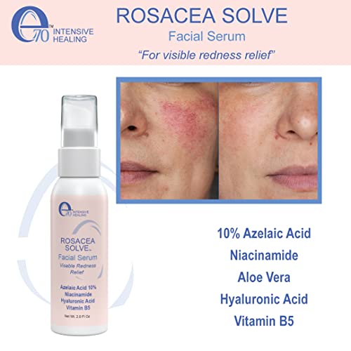 E70 Rosacea Serum - Redness Relief Serum For Rosacea and Acne-Prone Skin - Skin Care With Beneficial Ingredients, Aloe Vera, Hyaluronic Acid, Almond Oil, Licorice & Chamomile Extracts - No Parabens