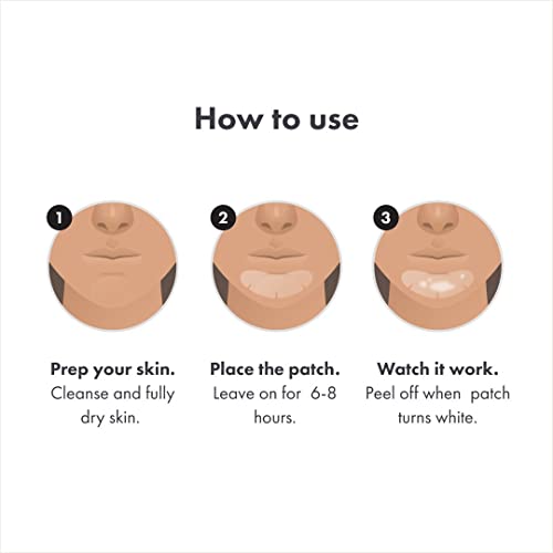 Hero Cosmetics Mighty Patch¢â Chin Patch - XL Contoured Hydrocolloid Chin Patch for Blemishes and Pimples - Non-Irritating (10 Count)
