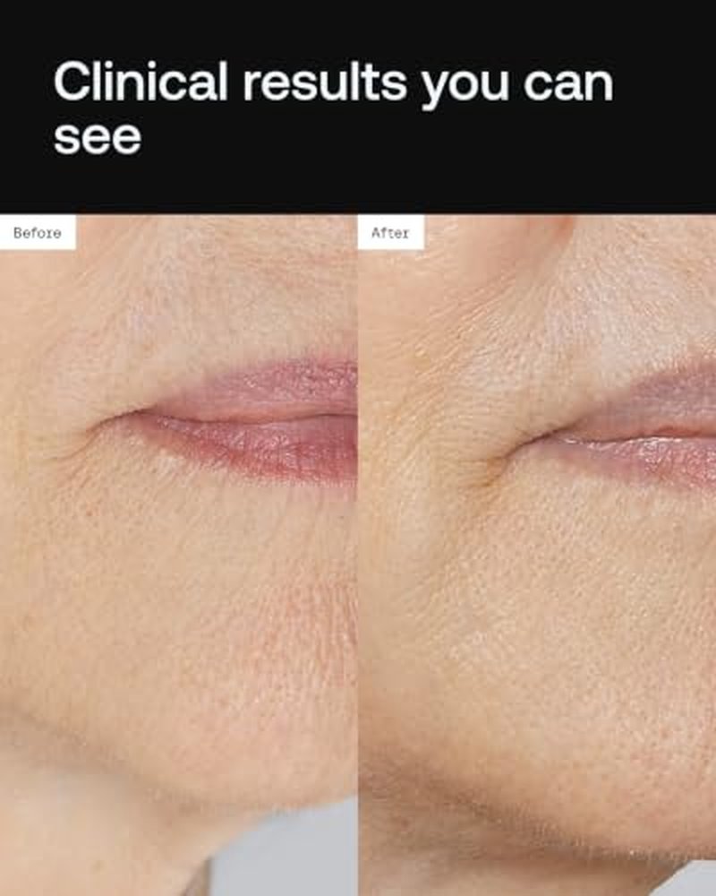 Angela Caglia Cell Forté Serum with Stem Cell Technology - 30ml