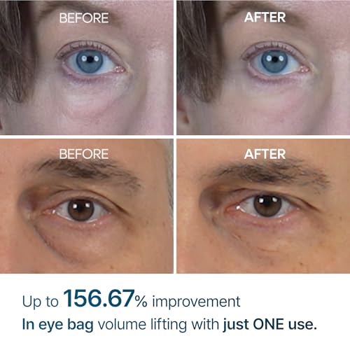 Dr.Melaxin Under Eye Cream for Dark Circles & Puffiness