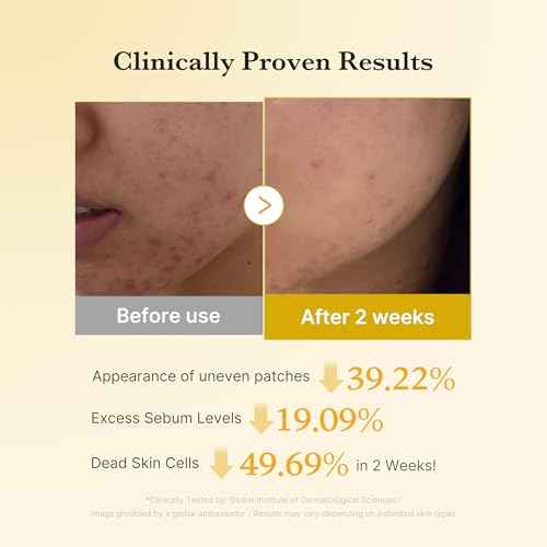 medicube Kojic Acid Turmeric Clarifying Toner Pad for Troubled Skin & Use After Spot Care, Soothing & Calming with Kojic Acid, Turmeric, Niacinamide & Glycolic Acid, Korean Skin Care, 70 Pads, 1 Pack