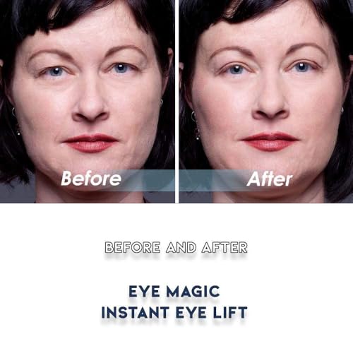 Eye Magic Premium Eye Lift Strips - 80 Count Medium