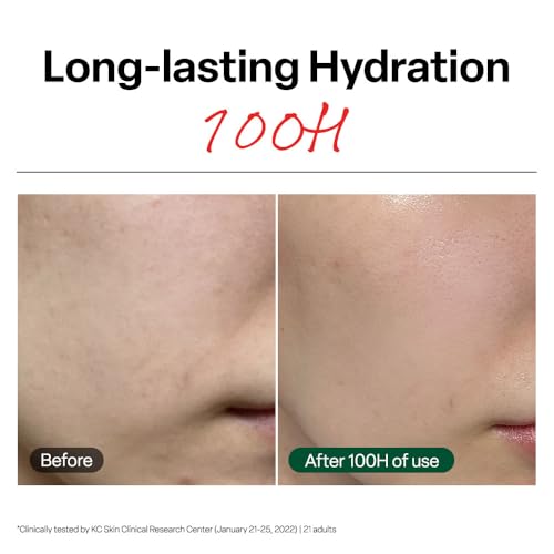 Dr. G R.E.D. Blemish Clear Soothing Cream 2.36 oz