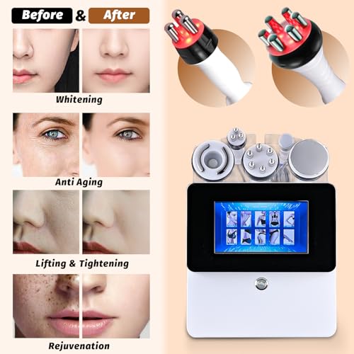 RF Body Beauty Machine for Face & Skin Tightening