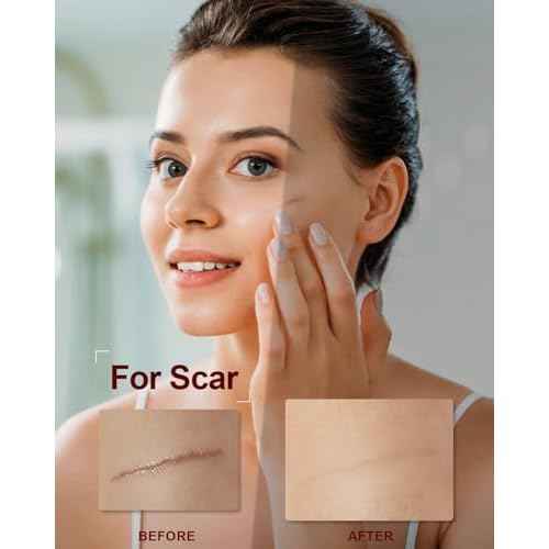 Organic Rosehip Seed Oil for Face,100 USDA Pure Rosehip Oils for Skin,Scars,Hair & Nails.2 fl Oz Cold Pressed Rose HIPS Oils for Skin Care, Anti-Aging, Scar Treatment, GUA SHA Massage Carrier Oil