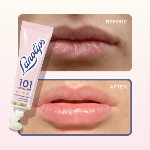 Lanolips 101 Ointment - Lanolin Lip Balm for Smooth, Hydrated & Healthy Lips - Multipurpose Lip Ointment with Lanolin Oil for Dry Lips, Cuticles & More - Original Superbalm (0.52 oz)