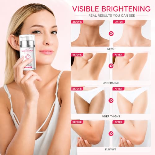 Skin Bleaching Cream with Vitamin C & Arbutin for Dark Spots