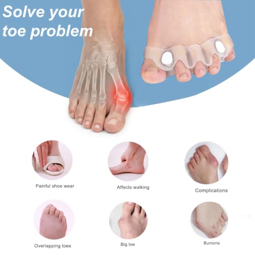 Silicone Toe Separators for Bunions & Hammer Toes (2 Pack)