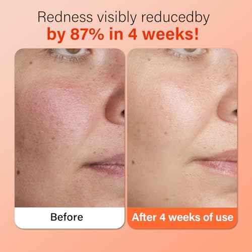 Extra Large Disposable Towels,suitable for Sensitive Skin,Fragrance-Free and Ultra Soft,Disposable Makeup Remover Cloths?,40 Count£¨1 Pack£©