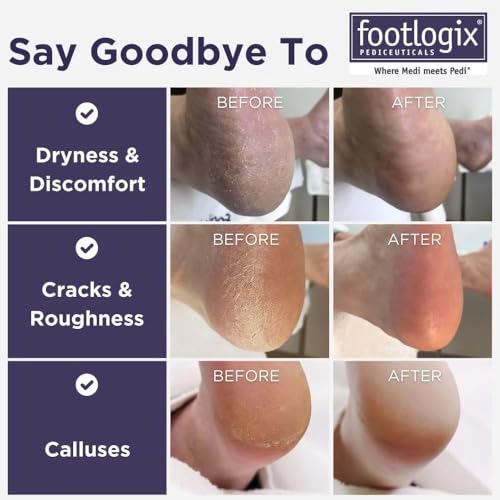 Footlogix Double-Sided Stainless Steel Foot File Coarse & Fine Grit – White / 1 Count