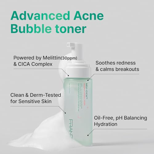 FRANZ Soothing Bubble Toner | Korean Skincare Acne Toner with CICA & Melittin | Calming & Redness Relief Formula | pH 6.0~6.5 Balancing & Oil Control for Sensitive, Acne-Prone Skin | 150ml / 5 fl.oz.