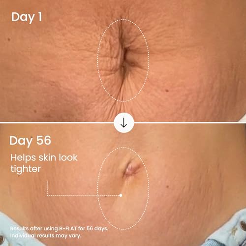 MAËLYS B-FLAT Belly Firming Cream for Stretch Marks, 2 Pack
