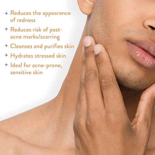 AcneFree Hypochlorous Acid Soothing Spray for Face & Body ? Redness Relief Mist for Acne-Prone, Sensitive, or Irritated Skin ? Gentle Daily Spray for Breakout Support & Skin Barrier Balance ? 4 ounce