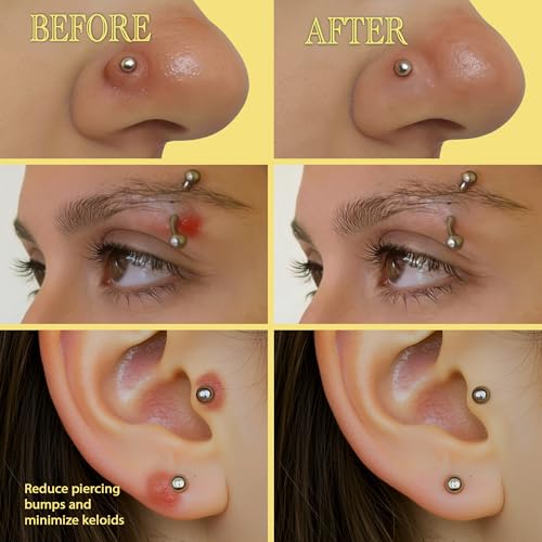BodyJ4You Keloid Bump Removal Oil - Piercing Aftercare Shrinking Drops