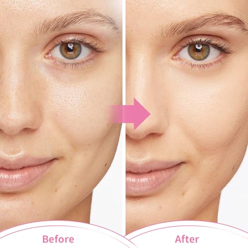 Cold & Hot Gel Bead Eye Mask – Dark Circles & Puffiness Relief