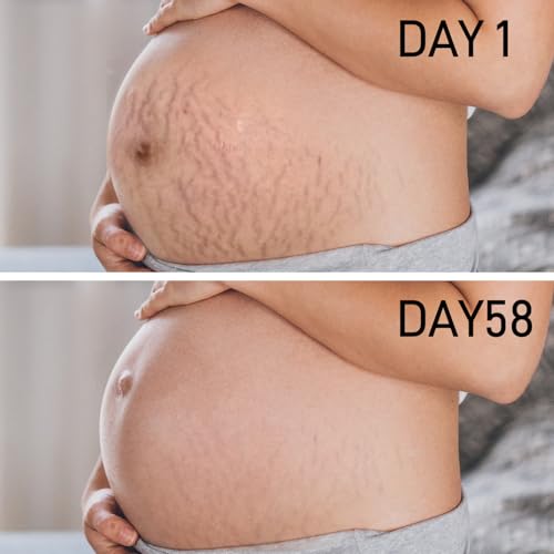 Pregnancy Stretch Mark Oil - Cocoa Butter & Vitamin E, 4.06oz