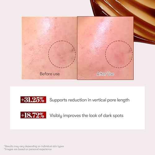 VT COSMETICS Red Booster Reedle Shot 100, Microneedling Serum with Dragon¡¯s Blood, Exosome, Soothing Relief Serum for Irritated, and Sun-Stressed Skin, Scalp Care, Korean Skincare 1.69 fl oz (50ml)