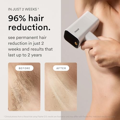 Nood Flasher Pro IPL Laser Hair Removal Device 1 Count Gloss White