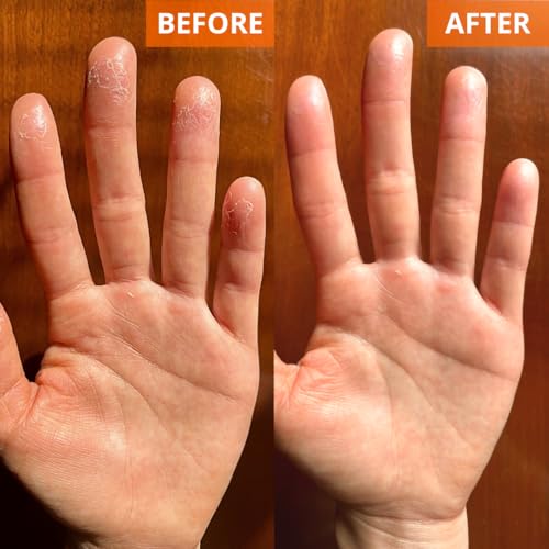 Yu-Be Moisturizing Skin Cream 4.4 Fl. Oz. Jar I Deeply Hydrating Non-Greasy Moisturizer for Dry Skin I Soothing Camphor Calms, Cools, & Relieves Skin I Vitamins Nourish, Repair & Rejuvenate