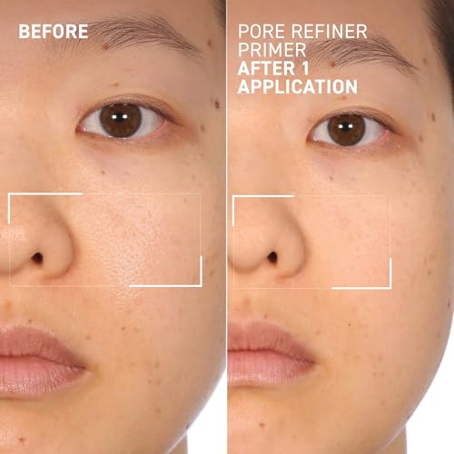 MoistureGlow¢â Plumping Lip Serum