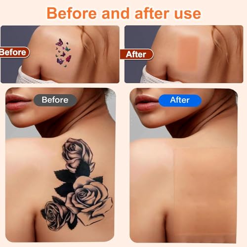 Lvnwrip 10 Pack Invisible Waterproof Tattoo Cover Patches for Dark Skin
