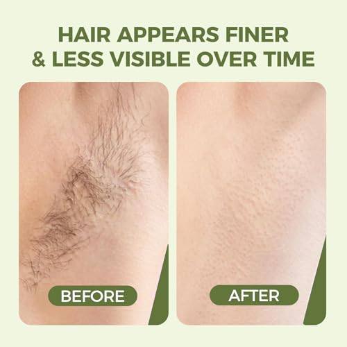 Cyperus Rotundus Hair Removal Oil - 60ml