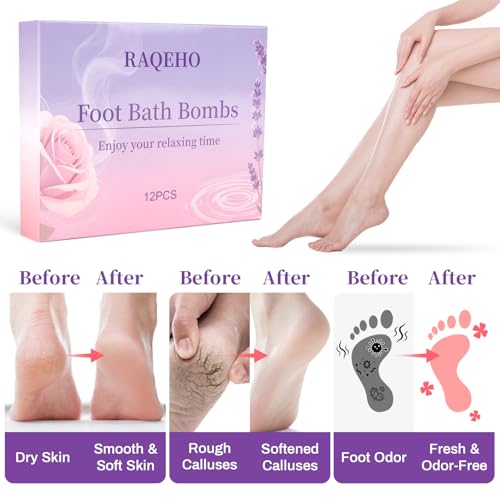 12-Piece Foot Bath Bombs - Rose & Lavender Foot Soak for Dry Cracked Feet