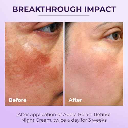 ABERA Belani Retinol Night Cream with Collagen & Hyaluronic Acid ? Anti-Wrinkle, Fine Line Smoother, Even Skin Tone, Hydrating Facial Moisturizer for Women (1.01 Fl Oz)