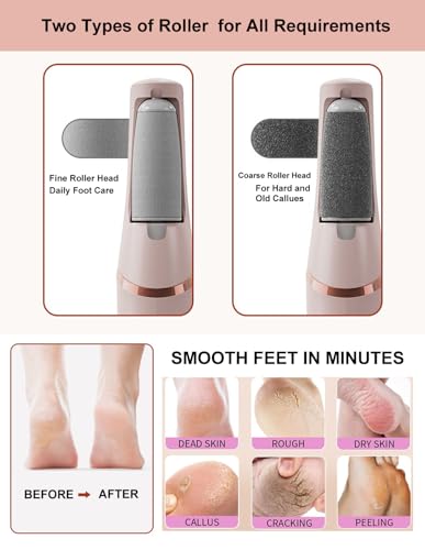 MOVELOVE White Rechargeable Electric Callus Remover for Feet, Dual Speed Foot File