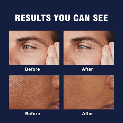 6-in-1 Face Cream for Men ? Mens Anti Aging Face Cream w/Caffeine & Retinol to Firm, Hydrate & Refresh Skin, Quick-Absorbing Non-Greasy Formula