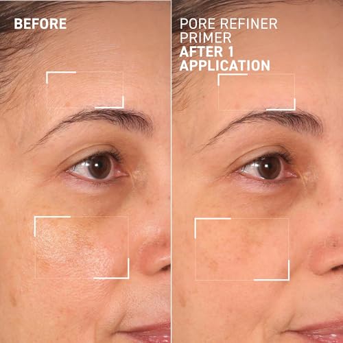 MoistureGlow¢â Plumping Lip Serum