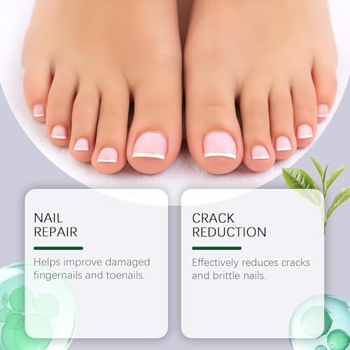 Terquenix Toenail Fungus Treatment Pen – Extra Strength