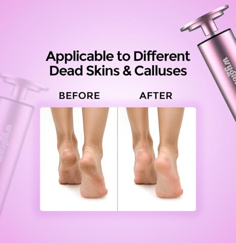 Electric Callus Remover & Nail File Drill Kit - 2-in-1 Rechargeable Pedicure Tool
