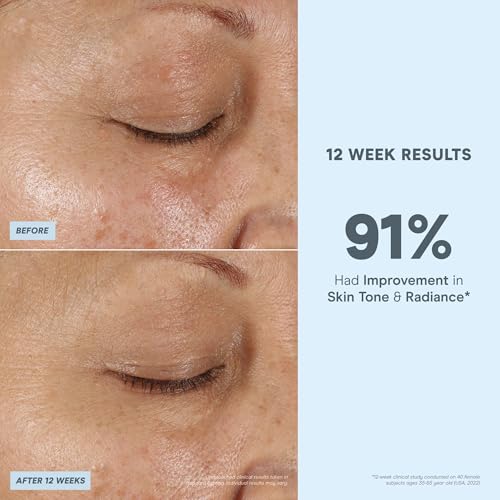 NuFACE Vita-C Brightening Face Serum - Vitamin C Serum for Dark Spots & Even Skin Tone + Niacinamide for Soothing Redness - Boosts Results of Microcurrent Treatments, Daily Skin Care (1oz)